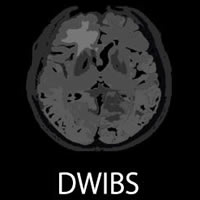 DWIBS（ドゥイブス）法とは