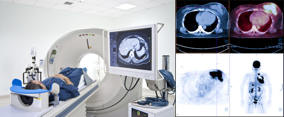 PET検査の様子と診断画像