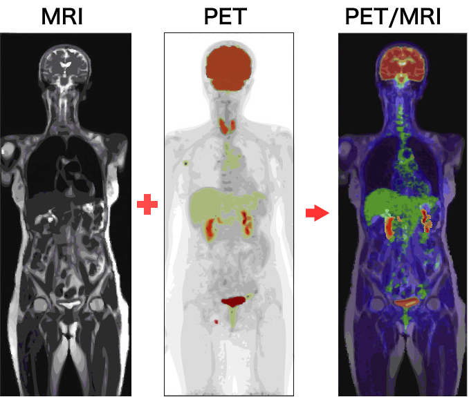 PET-MRIの画像イメージ